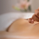acupuncture cupping therapy in Milwaukee