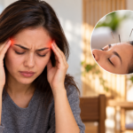 acupuncture for migraines in Milwaukee